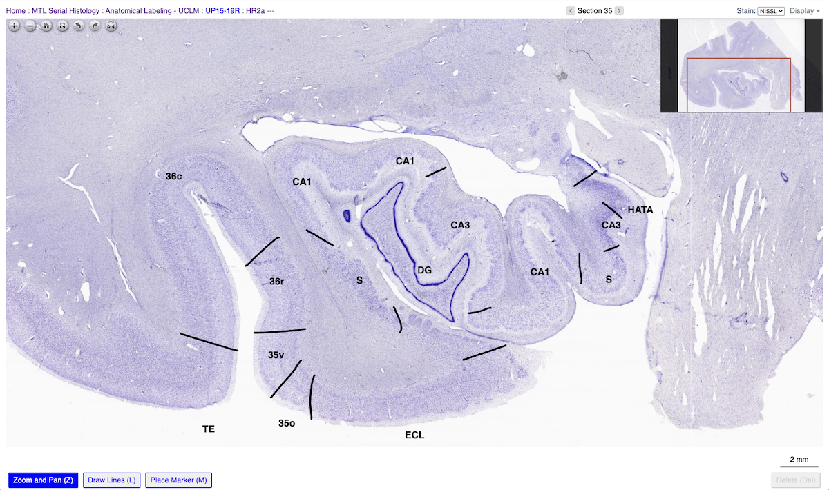 Screenshot of the Annotation Archive